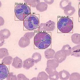 View of blood cells and bouding boxes around them
