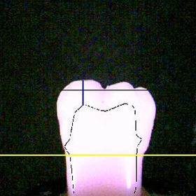 Photo of a tooth alone, in a black background