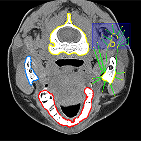 View of a CT image with certain parts of it highlighted