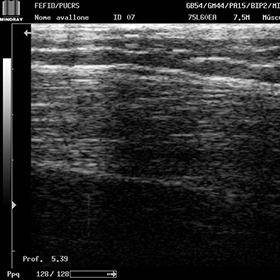 View of an ultrasound image